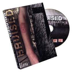 Bruised by Daniel Martin