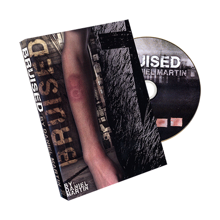 Bruised by Daniel Martin